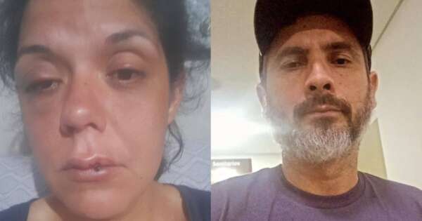 Diario HOY | Mujer denuncia brutal golpiza de su expareja y también desidia policial