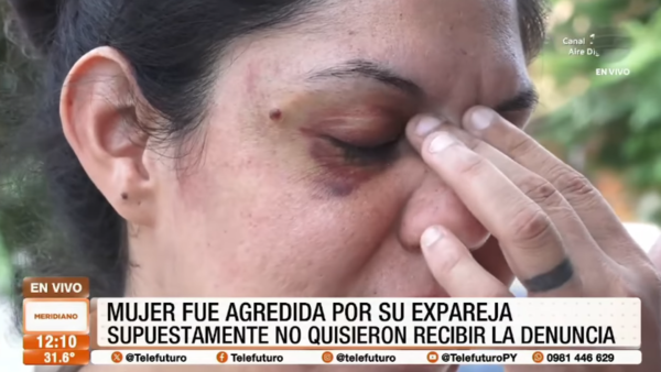 Mujer denunció que fue agredida por su expareja