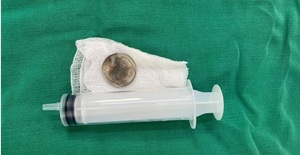 Ineram extrae monedas a niños de 3 y 9 años: Ya van cuatro casos en 2026