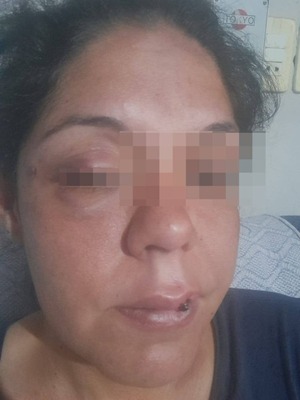 Mujer que sufrió agresión por parte de su ex pareja reclama justicia