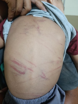 Detienen a madrastra por presunto maltrato a niño de 3 años - trece