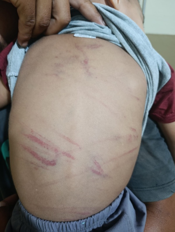 Detienen a madrastra por presunto maltrato a niño de 3 años - trece