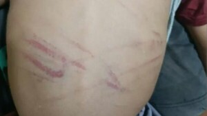 Una mujer es señalada por golpear con cable a su hijastro de 3 años y queda detenida en Capiatá