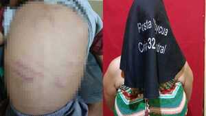 Madrastra fue detenida por golpear con cable a un niño de 3 años