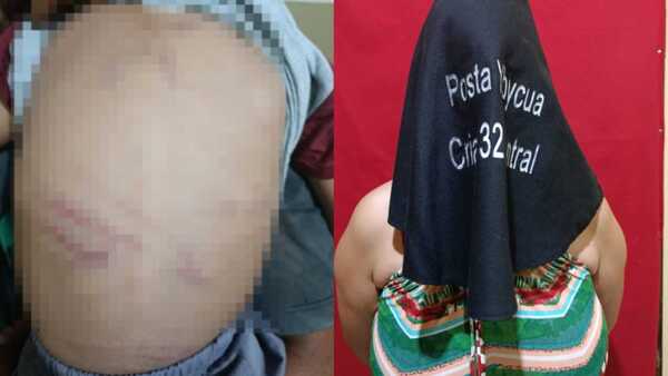 Madrastra fue detenida por golpear con cable a un niño de 3 años