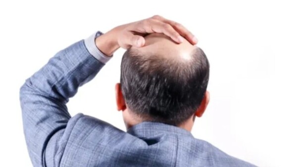 Decirle “pelado” al compañero puede ser acoso, según fallo histórico