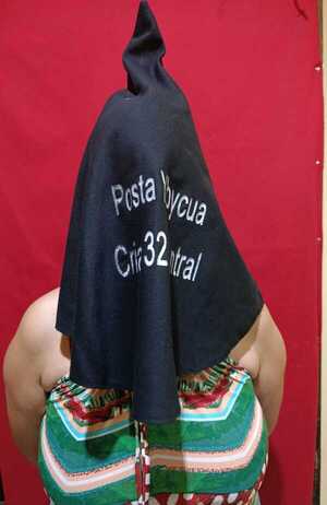 Popular / Madrastra dejó marcado a niño de 3 añitos 