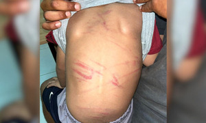 Detienen a madrastra en Capiatá tras denuncia por presunto maltrato a un niño de 3 años - OviedoPress