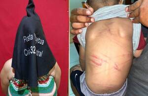 Mitã’i de 3 años fue agredido brutalmente; cae la madrastra