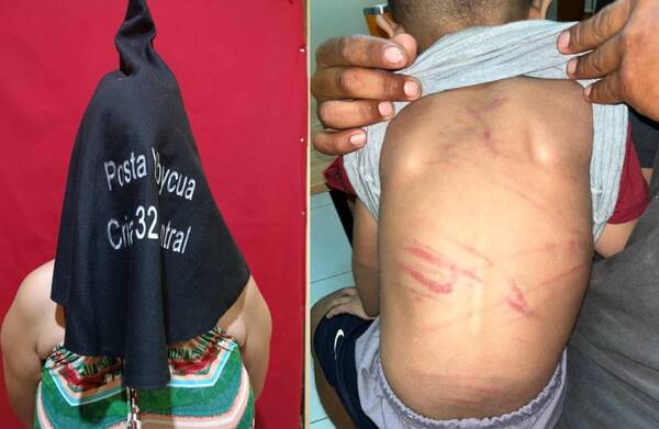 Mitã’i de 3 años fue agredido brutalmente; cae la madrastra