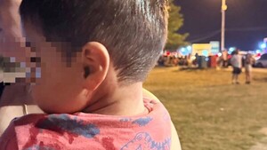 Niño de dos años quedó herido tras caerle un hierro en un juego de la Costanera