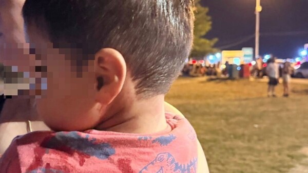 Niño de dos años quedó herido tras caerle un hierro en un juego de la Costanera