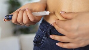 Diputado denuncia “campaña” contra adelgazante nacional