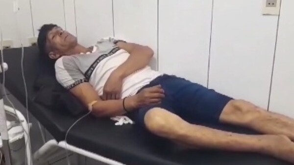 Un hombre fue mordido por una serpiente cuando iba a trabajar