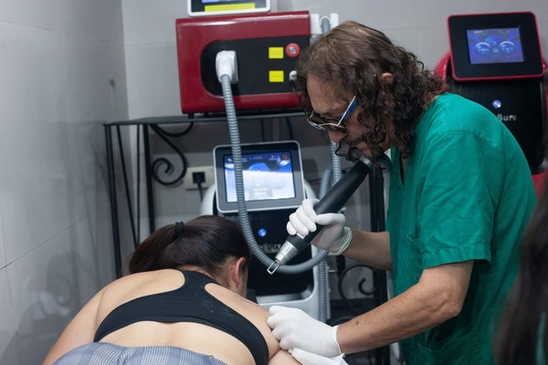 Eliminación de tatuajes con láser: ¿Cómo funciona?