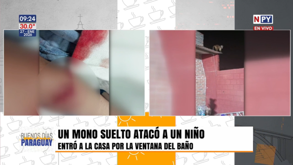 Terror en Loma Pytã: Niño de 3 años atacado por un mono en su vivienda