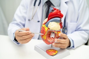 Más allá del infarto: cómo cuidar el corazón a tiempo - Portal Digital Cáritas Universidad Católica