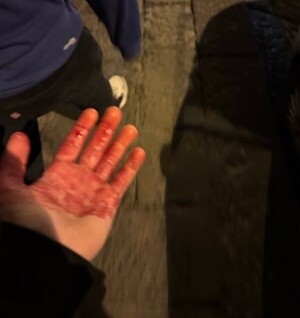 Dos hinchas del Chelsea acuchillados en Nápoles