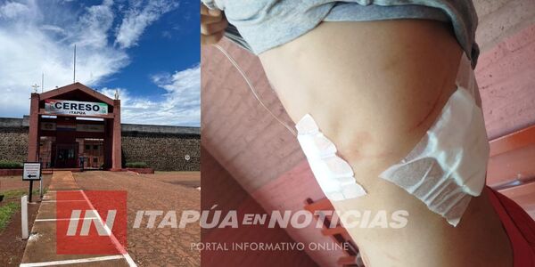  INTERNO RESULTA HERIDO TRAS RIÑA EN EL CERESO