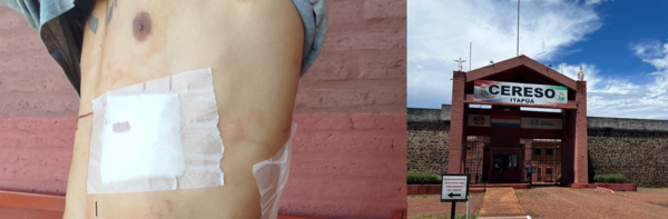 Riña entre internos deja un apuñalado en el penal de Itapúa