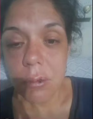 Mujer denuncia agresión y denuncia policial inicial es ignorada