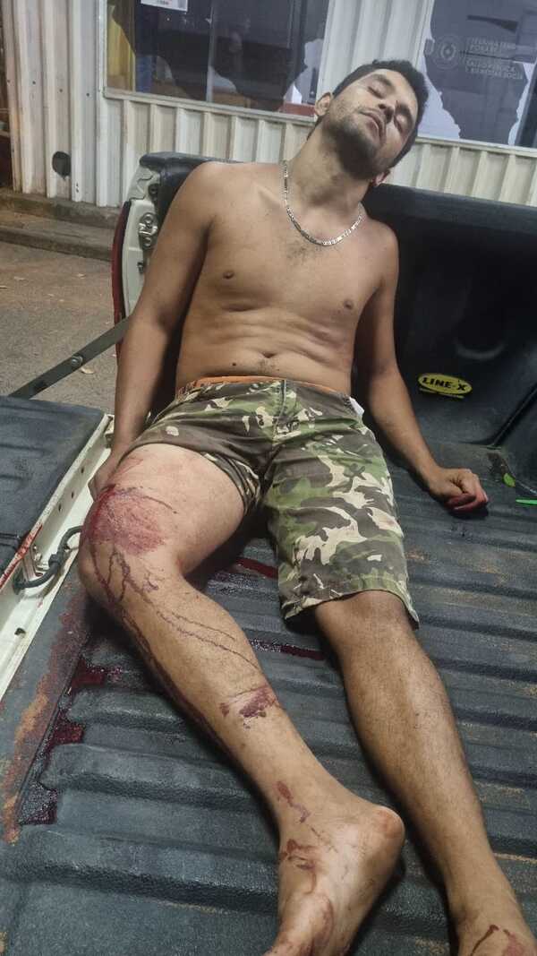 Popular / Joven ligó plomo y quedó hospitalizado