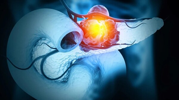 Investigador valora estudio experimental para el tratamiento del cáncer de páncreas