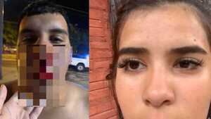 Pareja denunció violenta agresión y criticó inacción policial - Portal Digital Cáritas Universidad Católica