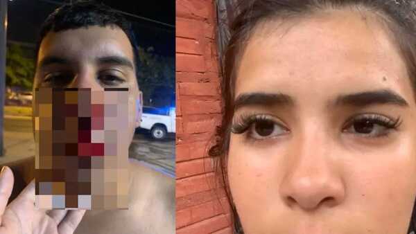 Pareja denunció violenta agresión y criticó inacción policial - Portal Digital Cáritas Universidad Católica