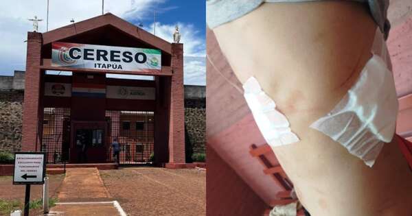 Diario HOY | Discusión por el desayuno acaba con un recluso herido en cárcel de Itapúa