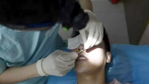 Latinos y árabes, cada vez más interesados en la cirugía estética