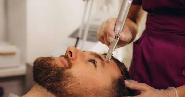 La Nación / Cada vez más hombres recurren a la cirugía estética en América Latina