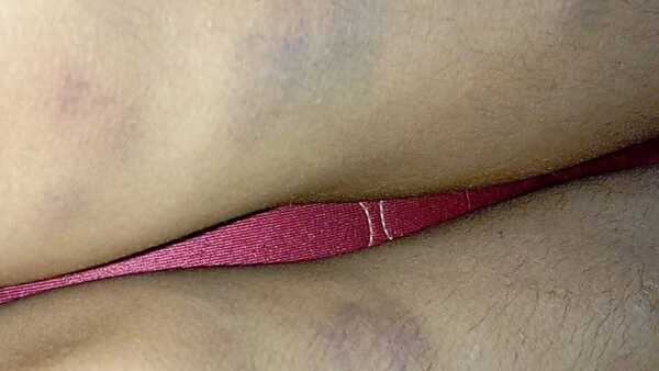 Joven que golpeó brutalmente a su pareja se beneficia con el arresto domiciliario y causa indignación