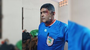 Perdían y le rompieron la ceja al cuarto árbitro