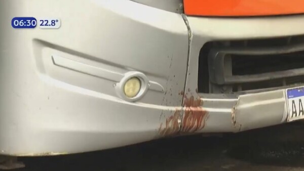 Pasajera de motocicleta sufre desprendimiento de cuero cabelludo tras choque con un bus