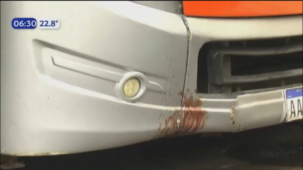 ¡Horror! Pasajera de plataforma quedó sin cuero cabelludo tras accidente