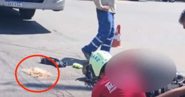 Diario HOY | Reportan estado de salud de mujer que perdió el cuero cabelludo en accidente