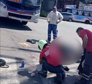 Pasajera de moto de plataforma pierde el cuero cabelludo en choque