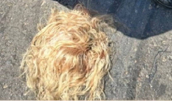 Accidente en Lambaré dejó a pasajera sin cuero cabelludo - Noticiero Paraguay