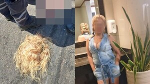 No usó casco por su cabello mojado y terminó sin cabellera