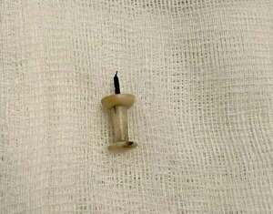 Adolescente de 15 años "tragó" un clavo hace cuatro años