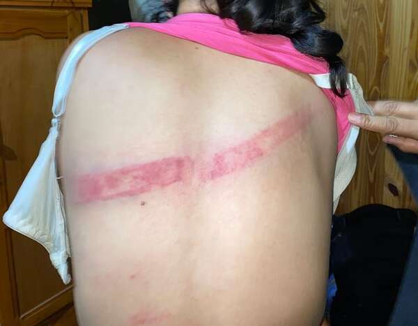 Villarrica: detienen a un hombre que habría golpeado con una varilla a su pareja - Policiales - ABC Color