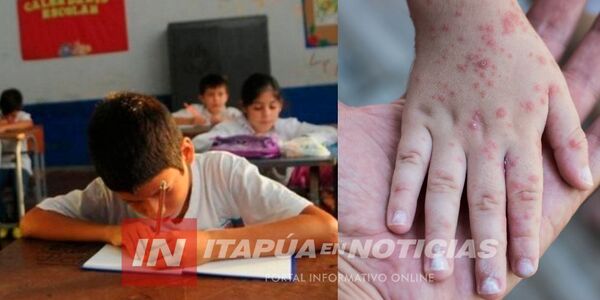 PAI ANUNCIA CAMPAÑA DE VACUNACIÓN CONTRA EL SARAMPIÓN EN ESCUELAS