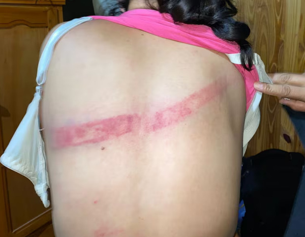 Detienen a hombre por agredir a su pareja con una varilla de hierro