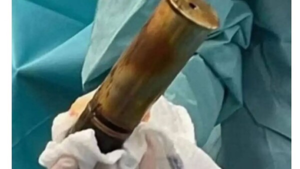 Llegó con un explosivo"ahí atrás” al hospital y armó sarambí