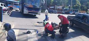 Mujer que perdió el cuero cabelludo iniciará tratamiento con tejidos donados - Nacionales - ABC Color