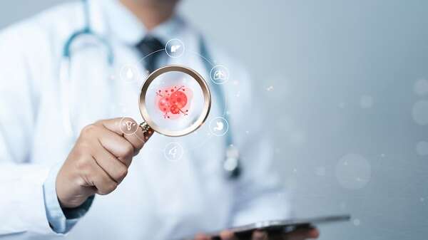 Cáncer y desinformación: cómo los mitos pueden poner en riesgo vidas - Ciencia - ABC Color