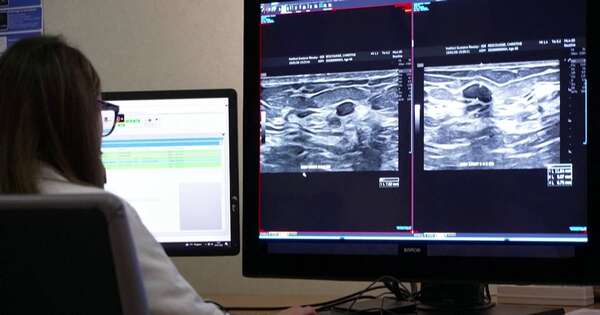 La Nación / OMS: 4 de cada 10 cánceres están ligados a factores evitables