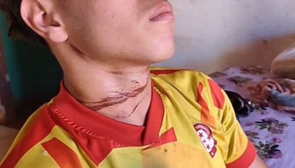 Video: cables sueltos provocan dos accidentes en Presidente Franco - ABC en el Este - ABC Color