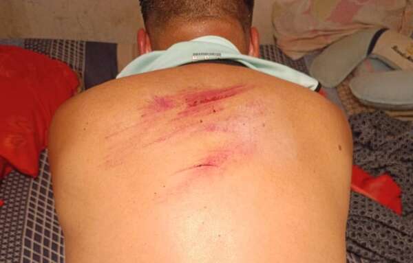 Video: familia detuvo a un asaltante y cómplices volvieron para vengarse  - ABC en el Este - ABC Color